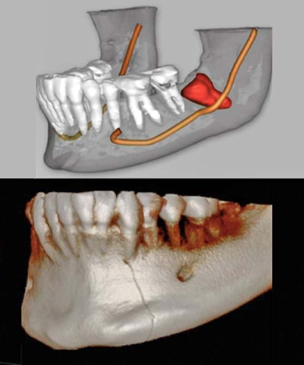 Tomografía Para Periodoncia