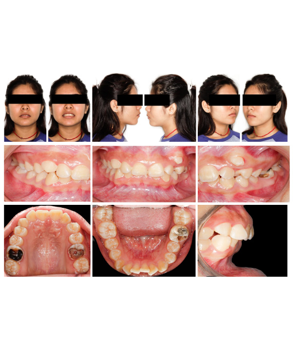 Fotos Intraorales y Extraorales para ortodoncia