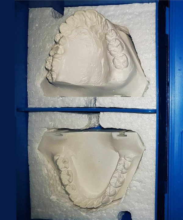 Modelos De Estudio Con Zócalo Prefabricado